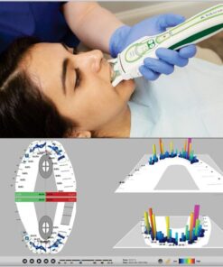 Máy phân tích khớp cắn điện toán T-Scan