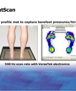 MATSCAN: Máy đo phân bố trọng lực lên 2 bàn chân sau khi cân bằng khớp cắn